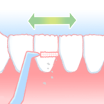西宮北口　歯医者　歯間ブラシ使い方