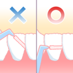 歯医者　西宮北口　歯間ブラシ使い方